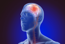 Clipart:10xq1pd7_Hy= Stroke