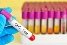 CBC Blood Test